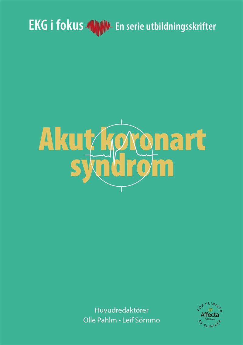 EKG i Fokus: Akut koronart syndrom/Arytmier